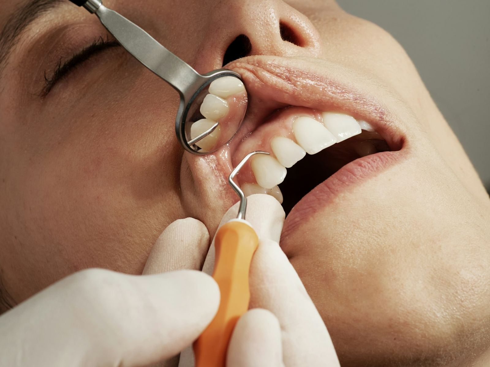 Restorative treatment
